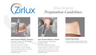 Zirlux Zirconia Preparations Guidelines