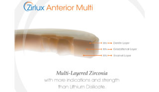 Zirlux anterior multi technical sheet