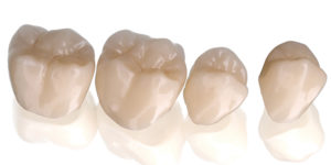 Zirlux 16+ zirconia crowns